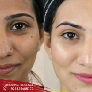 Results of Glutathione in islamabad