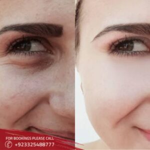 images of Glutathione in islamabad 