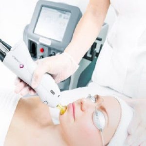 How Many Sessions are Needed for Facial Laser Hair Removal