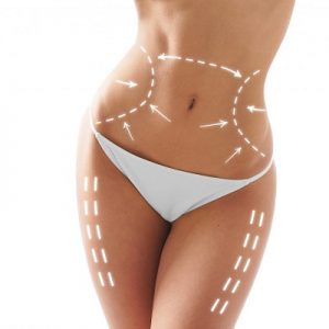 Liposuction Best Method To Get Rid Of Belly Fat