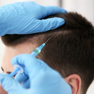 Robotic Versus Manual FUE Hair transplant