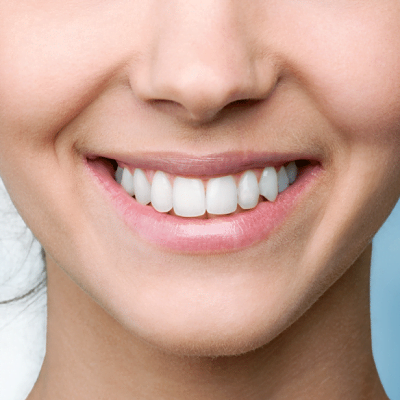 Top 10 Teeth Whitening Myths Islamabad