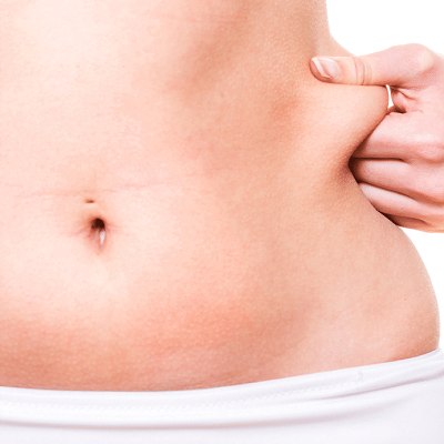 How Liposuction Improves the Shape of Face and Belly