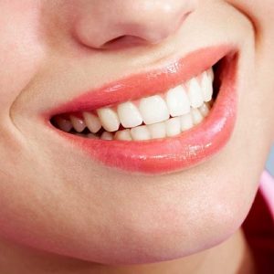 Teeth Whitening Treatment to get Whitest Smile in an hour