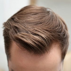 Benefits & Side effects of Hair Transplant