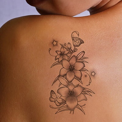 5 Things You Should Know about the Laser Tattoo Removal