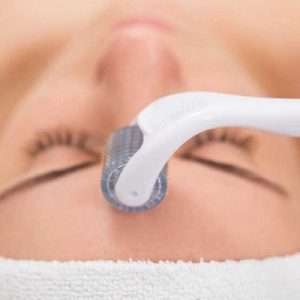 RF Fractional Micro needling the ideal combo