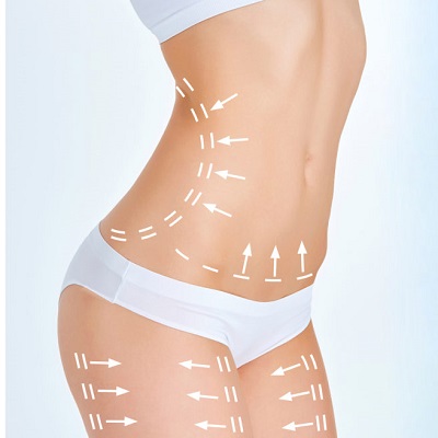 Achieving a Statuesque figure with Body Contouring Treatment