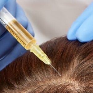 PRP Hair Treatment Cost in Islamabad