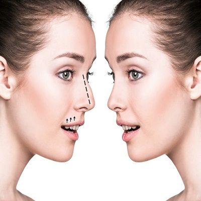 Septoplasty Surgery in Islamabad, Rawalpindi & Pakistan