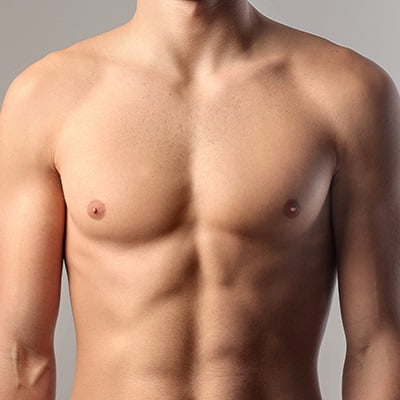 Effects of Gynecomastia on Looks and Health