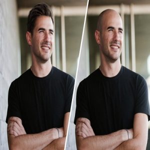 Advanced Hair Restoration Studio in Islamabad Pakistan