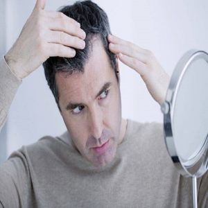 How to Avoid Side Effects of Hair Transplant in Islamabad