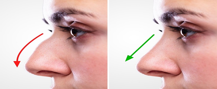 best rhinoplasty clinic in Islamabad Pakistan