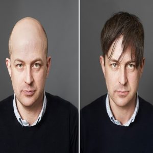 Best Hair Wigs Center In Rawalpindi