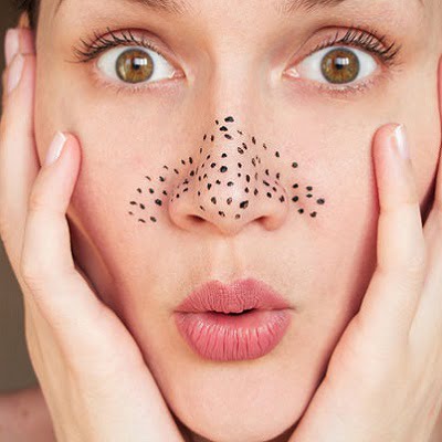 Blackhead Removal in Islamabad