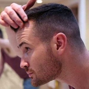 FUE Hair Transplant in Islamabad Pakistan Hurt