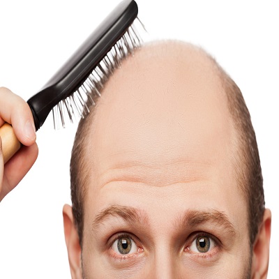 How Is COVID-19 Related To Hair Loss