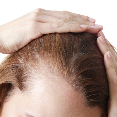 3 things You Did not Know Were Making Women Go Bald