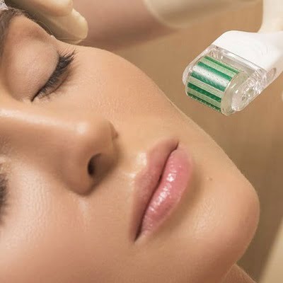 Microneedling For Acne Scars Cost in Islamabad