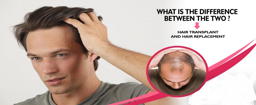 between Hair Transplant and Hair Replacement