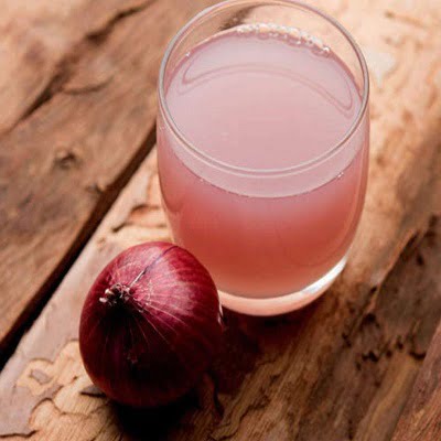 Does Onion Juice Really Cure Baldness and Hair Fall