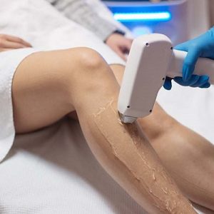 Laser Hair Removal Cost in Pakistan