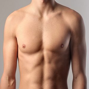 Best Gynecomastia Surgeon in Islamabad