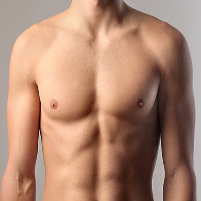 Best Gynecomastia Surgeon in Islamabad Pakistan