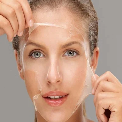 Chemical Skin Peels in Islamabad, Pakistan | SKN Clinic