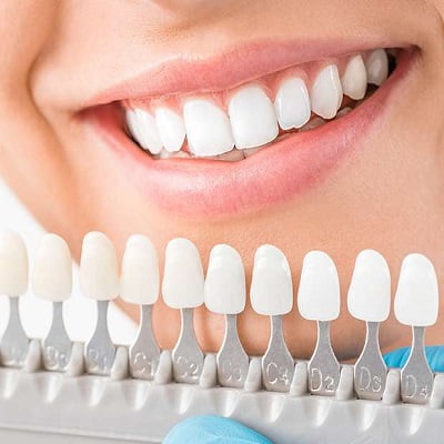 Cosmetic Dentistry in Islamabad, Rawalpindi & Pakistan