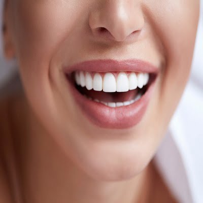 Dental Veneers treatment in Islamabad Pakistan