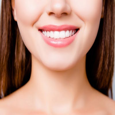 Digital Smile Design Treatment in Islamabad