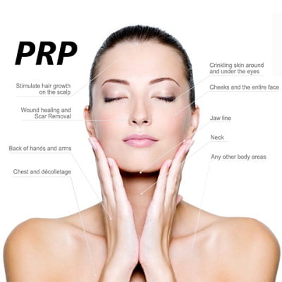 Filler Injections with PRP Islamabad, Rawalpindi & Pakistan