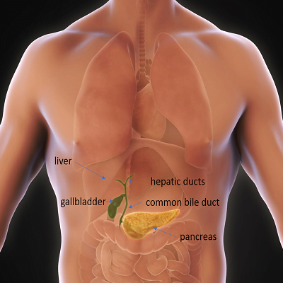 Gallbladder Stones Surgery in Islamabad, Rawalpindi & Pakistan