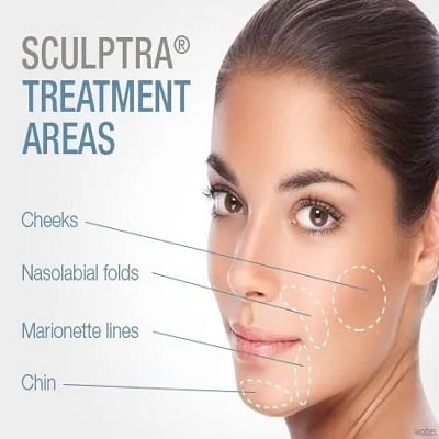 Sculptra Fillers in Islamabad, Rawalpindi & Pakistan