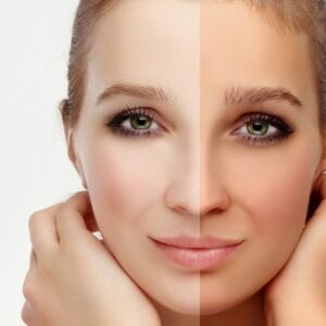 Do’s and Don’ts for Skin whitening injections