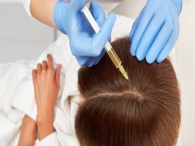 Mesotherapy For Hair Loss in Islamabad