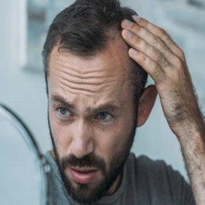 Hair Transplant for Young Adults