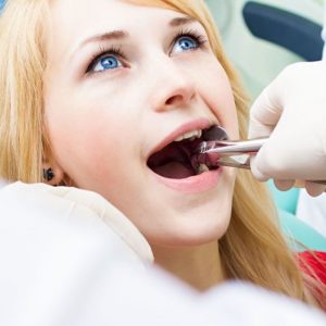 Wisdom Tooth Extraction Cost In Islamabad