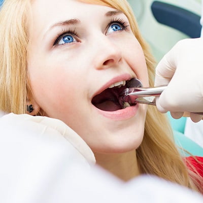 Wisdom Tooth Extraction Cost in Islamabad