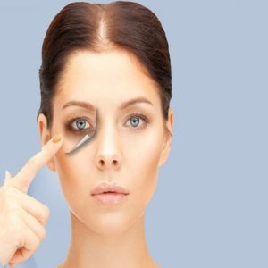 Dark Circle Treatment Cost in Islamabad