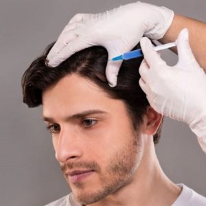 PRP For Hair Treatment Success Rate in Islamabad