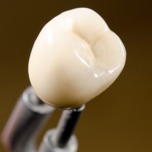 Teeth Cap Price in Pakistan