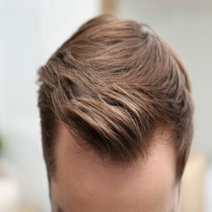 How Much Does the FUE Hair Transplant Cost