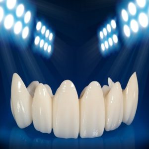 Zirconia Crown Price in Pakistan