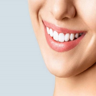 Teeth whitening in Islamabad