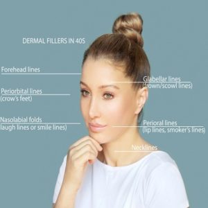 Cost of Dermal Fillers in Islamabad