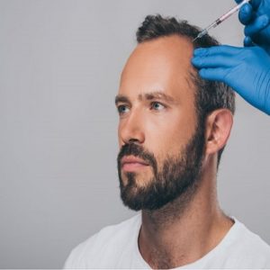 PRP After Hair Transplant