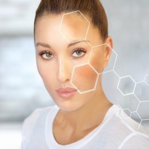 Chemical Peel For Hyperpigmentation